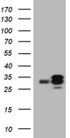 PPT1 / CLN1 Antibody - HEK293T cells were transfected with the pCMV6-ENTRY control (Left lane) or pCMV6-ENTRY PPT1 (Right lane) cDNA for 48 hrs and lysed. Equivalent amounts of cell lysates (5 ug per lane) were separated by SDS-PAGE and immunoblotted with anti-PPT1.
