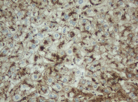 PPT1 / CLN1 Antibody - IHC of paraffin-embedded Human liver tissue using anti-PPT1 mouse monoclonal antibody.