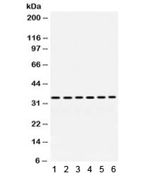 PPT1 / CLN1 Antibody