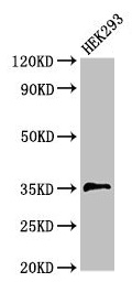 PPT1 / CLN1 Antibody - Western Blot Positive WB detected in: HEK293 whole cell lysate All lanes: PPT1 antibody at 3.5µg/ml Secondary Goat polyclonal to rabbit IgG at 1/50000 dilution Predicted band size: 35, 24 kDa Observed band size: 35 kDa