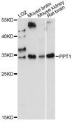 PPT1 / CLN1 Antibody - Western blot analysis of extracts of various cell lines, using PPT1 antibody at 1:1000 dilution. The secondary antibody used was an HRP Goat Anti-Rabbit IgG (H+L) at 1:10000 dilution. Lysates were loaded 25ug per lane and 3% nonfat dry milk in TBST was used for blocking. An ECL Kit was used for detection and the exposure time was 30s.