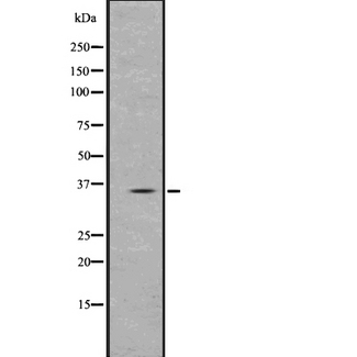 PPT1 / CLN1 Antibody - Western blot analysis of PPT1 using Jurkat whole lysates.