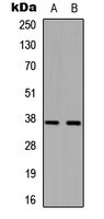 PPT1 / CLN1 Antibody - Western blot analysis of PPT expression in HepG2 (A); K562 (B) whole cell lysates.