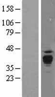 PPT1 / CLN1 Protein - Western validation with an anti-DDK antibody * L: Control HEK293 lysate R: Over-expression lysate