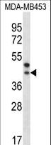 PPT2 Antibody - PPT2 Antibody western blot of MDA-MB453 cell line lysates (35 ug/lane). The PPT2 antibody detected the PPT2 protein (arrow).