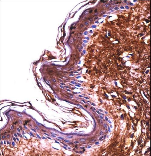 PPT2 Antibody - PPT2 Antibody immunohistochemistry of formalin-fixed and paraffin-embedded human skin tissue followed by peroxidase-conjugated secondary antibody and DAB staining.