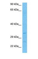 PPT2 Antibody - Western blot of PPT2 Antibody with human Fetal Liver lysate.  This image was taken for the unconjugated form of this product. Other forms have not been tested.