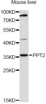 PPT2 Antibody - Western blot analysis of extracts of mouse liver, using PPT2 antibody at 1:3000 dilution. The secondary antibody used was an HRP Goat Anti-Rabbit IgG (H+L) at 1:10000 dilution. Lysates were loaded 25ug per lane and 3% nonfat dry milk in TBST was used for blocking. An ECL Kit was used for detection and the exposure time was 90s.