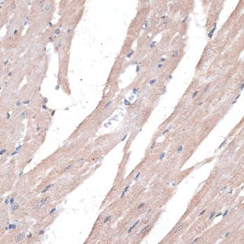 PPT2 Antibody - Immunohistochemistry of paraffin-embedded Mouse heart using PPT2 Polyclonal Antibody at dilution of 1:100 (40x lens).
