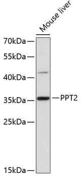 PPT2 Antibody - Western blot analysis of extracts of mouse liver using PPT2 Polyclonal Antibody at dilution of 1:3000.