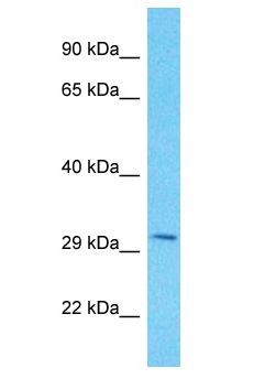 PPTC7 Antibody - PPTC7 antibody Western Blot of MDA-MB-435S. Antibody dilution: 1 ug/ml.  This image was taken for the unconjugated form of this product. Other forms have not been tested.
