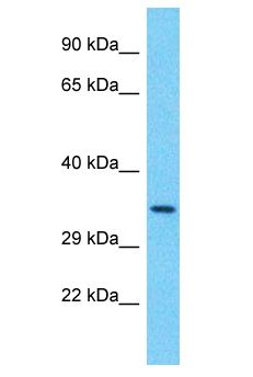 PPTC7 Antibody - PPTC7 antibody Western Blot of RPMI-8226. Antibody dilution: 1 ug/ml.  This image was taken for the unconjugated form of this product. Other forms have not been tested.