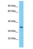 PPTC7 Antibody - PPTC7 antibody Western Blot of RPMI-8226. Antibody dilution: 1 ug/ml.  This image was taken for the unconjugated form of this product. Other forms have not been tested.