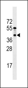 PPTC7 Antibody - PPTC7 Antibody western blot of mouse bladder tissue lysates (35 ug/lane). The PPTC7 antibody detected the PPTC7 protein (arrow).
