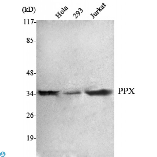 PPX Antibody - Western Blot (WB) analysis using PPX Monoclonal Antibody against HeLa, 293, Jurkat cell lysate.