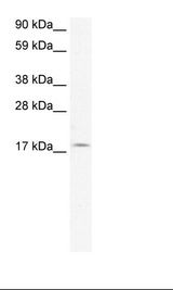 PQBP1 Antibody - Fetal Lung Lysate.  This image was taken for the unconjugated form of this product. Other forms have not been tested.