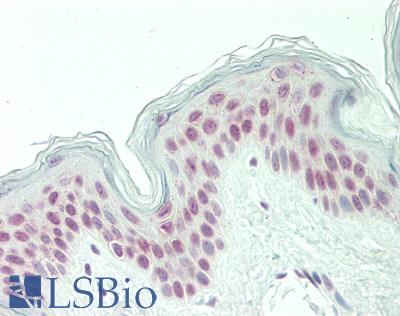 PQBP1 Antibody - Human Skin: Formalin-Fixed, Paraffin-Embedded (FFPE).  This image was taken for the unconjugated form of this product. Other forms have not been tested.