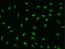 PQBP1 Antibody - Immunofluorescence staining of PQBP1 in HeLa cells. Cells were fixed with 4% PFA, permeabilzed with 0.1% Triton X-100 in PBS, blocked with 10% serum, and incubated with rabbit anti-human PQBP1 polyclonal antibody (dilution ratio 1:1000) at 4°C overnight. Then cells were stained with the Alexa Fluor 488-conjugated Goat Anti-rabbit IgG secondary antibody (green). Positive staining was localized to Nucleus.