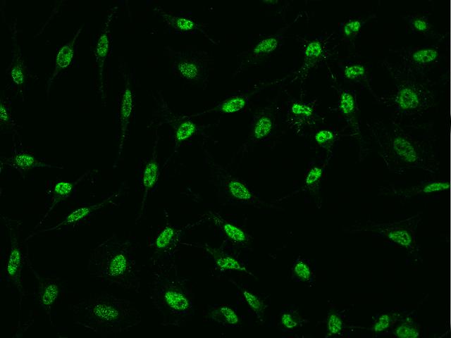 PQBP1 Antibody - Immunofluorescence staining of PQBP1 in HeLa cells. Cells were fixed with 4% PFA, permeabilzed with 0.1% Triton X-100 in PBS, blocked with 10% serum, and incubated with rabbit anti-human PQBP1 polyclonal antibody (dilution ratio 1:1000) at 4°C overnight. Then cells were stained with the Alexa Fluor 488-conjugated Goat Anti-rabbit IgG secondary antibody (green). Positive staining was localized to Nucleus.