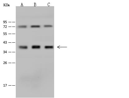 PQBP1 Antibody - Anti-PQBP1 rabbit polyclonal antibody at 1:500 dilution. Lane A: HeLa Whole Cell Lysate. Lane B: 293T Whole Cell Lysate. Lane C: HepG2 Whole Cell Lysate. Lysates/proteins at 30 ug per lane. Secondary: Goat Anti-Rabbit IgG (H+L)/HRP at 1/10000 dilution. Developed using the ECL technique. Performed under reducing conditions. Predicted band size: 30 kDa. Observed band size: 38 kDa.