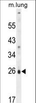 PQLC1 Antibody - PQLC1 Antibody western blot of mouse lung tissue lysates (35 ug/lane). The PQLC1 antibody detected the PQLC1 protein (arrow).