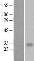 PQLC1 Protein - Western validation with an anti-DDK antibody * L: Control HEK293 lysate R: Over-expression lysate