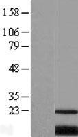 PQLC2 Protein - Western validation with an anti-DDK antibody * L: Control HEK293 lysate R: Over-expression lysate