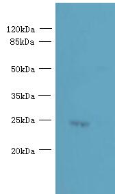 PQLC3 Antibody - Western blot. All lanes: PQLC3 antibody at 3 ug/ml+ Mouse liver tissue Goat polyclonal to rabbit at 1:10000 dilution. Predicted band size: 23 kDa. Observed band size: 23 kDa.