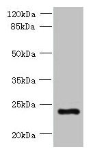 PQLC3 Antibody - Western blot All lanes: PQLC3 antibody at 3µg/ml + Mouse liver tissue Secondary Goat polyclonal to rabbit IgG at 1/10000 dilution Predicted band size: 23, 21 kDa Observed band size: 23 kDa
