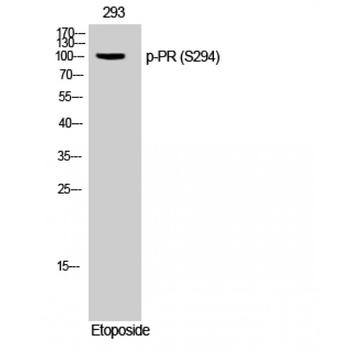 PR / Progesterone Receptor Antibody - Western blot of Phospho-PR (S294) antibody