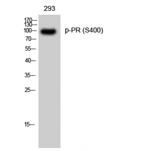 PR / Progesterone Receptor Antibody - Western blot of Phospho-PR (S400) antibody