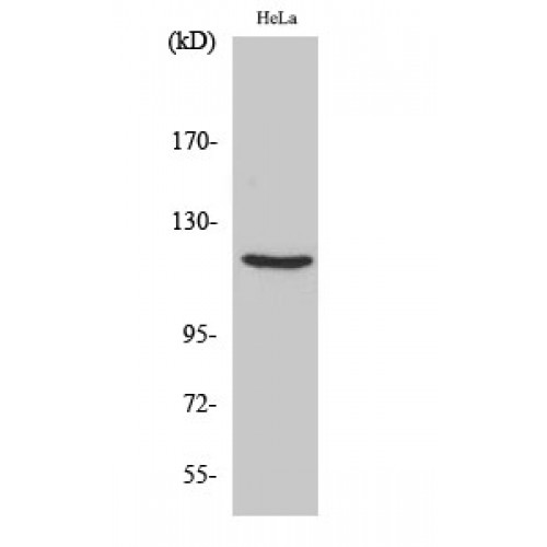 PR / Progesterone Receptor Antibody - Western blot of PR antibody
