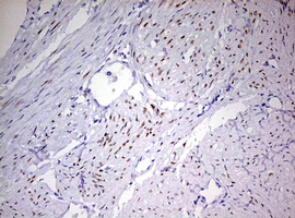 PR / Progesterone Receptor Antibody - IHC of paraffin-embedded Human endometrium tissue using anti-PGR mouse monoclonal antibody. (Heat-induced epitope retrieval by 10mM citric buffer, pH6.0, 120°C for 3min).