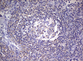 PR / Progesterone Receptor Antibody - IHC of paraffin-embedded Human tonsil using anti-PGR mouse monoclonal antibody. (Heat-induced epitope retrieval by 10mM citric buffer, pH6.0, 120°C for 3min).