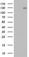 PR / Progesterone Receptor Antibody - HEK293T cells were transfected with the pCMV6-ENTRY control (Left lane) or pCMV6-ENTRY PGR (Right lane) cDNA for 48 hrs and lysed. Equivalent amounts of cell lysates (5 ug per lane) were separated by SDS-PAGE and immunoblotted with anti-PGR.