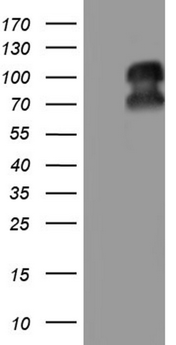 PR / Progesterone Receptor Antibody - HEK293T cells were transfected with the pCMV6-ENTRY control (Left lane) or pCMV6-ENTRY PGR (Right lane) cDNA for 48 hrs and lysed. Equivalent amounts of cell lysates (5 ug per lane) were separated by SDS-PAGE and immunoblotted with anti-PGR.