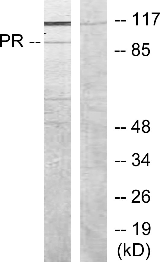 PR / Progesterone Receptor Antibody - Western blot analysis of lysates from COS7 cells, treated with EGF, using Progesterone Receptor Antibody. The lane on the right is blocked with the synthesized peptide.