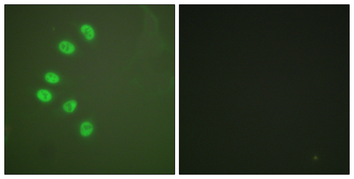 PR / Progesterone Receptor Antibody - Immunofluorescence analysis of A549 cells, using Progesterone Receptor Antibody. The picture on the right is blocked with the synthesized peptide.