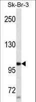 PR / Progesterone Receptor Antibody - PGR/PR Antibody western blot of SK-BR-3 cell line lysates (35 ug/lane). The PGR/PR antibody detected the PGR/PR protein (arrow).