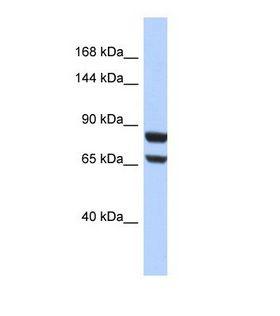 PR / Progesterone Receptor Antibody - Western blot of Human HepG2. PGR antibody dilution 1.0 ug/ml.  This image was taken for the unconjugated form of this product. Other forms have not been tested.