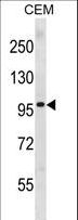 PR / Progesterone Receptor Antibody - PGR Antibody western blot of CEM cell line lysates (35 ug/lane). The PGR antibody detected the PGR protein (arrow).