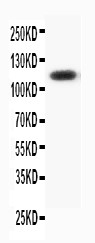 PR / Progesterone Receptor Antibody - WB of PGR/PR/Progesterone Receptor antibody. All lanes: Anti-PGR at 0.5ug/ml. WB: HELA Whole Cell Lysate at 40ug. Predicted bind size: 99KD. Observed bind size: 110KD.
