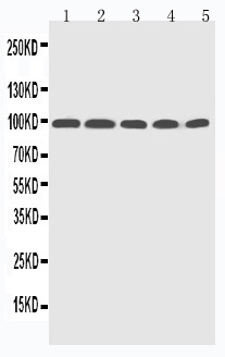 PR / Progesterone Receptor Antibody - WB of PGR/PR/Progesterone Receptor antibody. All lanes: Anti-Progesterone Receptor at 0.5ug/ml. Lane 1: HELA Whole Cell Lysate at 40ug. Lane 2: MCF-7 Whole Cell Lysate at 40ug. Lane 3: SKOV Whole Cell Lysate at 40ug. Lane 4: Rat Brain Tissue Lysate at 40ug. Lane 5: Rat Testis Tissue Lysate at 40ug. Predicted bind size: 99KD. Observed bind size: 99KD.