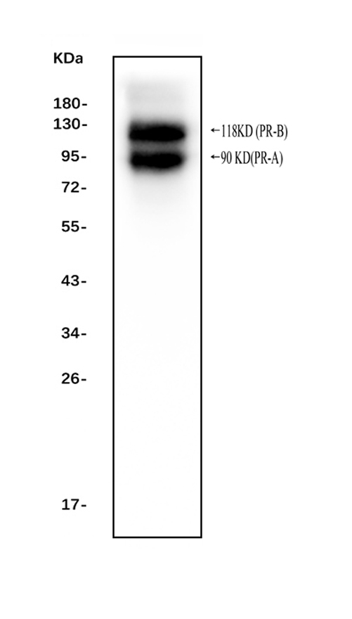 PR / Progesterone Receptor Antibody - Western blot analysis of Progesterone Receptor using anti-Progesterone Receptor antibody. Electrophoresis was performed on a 5-20% SDS-PAGE gel at 70V (Stacking gel) / 90V (Resolving gel) for 2-3 hours. The sample well of each lane was loaded with 50ug of sample under reducing conditions. Lane 1: human T-47D whole cell lysates, After Electrophoresis, proteins were transferred to a Nitrocellulose membrane at 150mA for 50-90 minutes. Blocked the membrane with 5% Non-fat Milk/ TBS for 1.5 hour at RT. The membrane was incubated with rabbit anti-Progesterone Receptor antigen affinity purified polyclonal antibody at 0.1 µg/mL overnight at 4°C, then washed with TBS-0.1% Tween 3 times with 5 minutes each and probed with a goat anti-rabbit IgG-HRP secondary antibody at a dilution of 1:10000 for 1.5 hour at RT. The signal is developed using an Enhanced Chemiluminescent detection (ECL) kit with Tanon 5200 system. A specific band was detected for Progesterone Receptor at approximately 90 KD (PR-A), 118KD (PR-B). The expected band size for Progesterone Receptor is at 99KD.