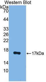 PR / Progesterone Receptor Antibody - Western Blot; Sample: Recombinant protein.