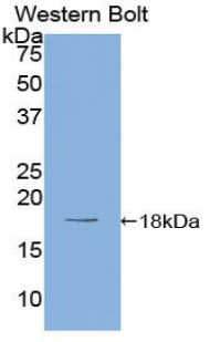 PR / Progesterone Receptor Antibody - Western blot of recombinant PGR/PR/Progesterone Receptor.  This image was taken for the unconjugated form of this product. Other forms have not been tested.