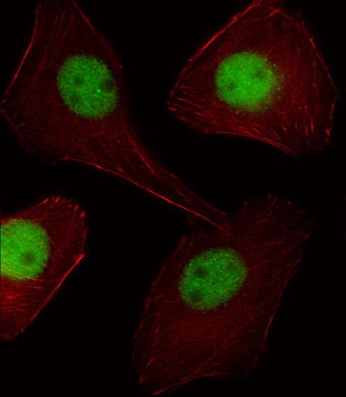 PR / Progesterone Receptor Antibody - Fluorescent image of U251 cell stained with PGR/PR Antibody. U251 cells were fixed with 4% PFA (20 min), permeabilized with Triton X-100 (0.1%, 10 min), then incubated with PGR/PR primary antibody (1:25, 1 h at 37°C). For secondary antibody, Alexa Fluor 488 conjugated donkey anti-rabbit antibody (green) was used (1:400, 50 min at 37°C). Cytoplasmic actin was counterstained with Alexa Fluor 555 (red) conjugated Phalloidin (7units/ml, 1 h at 37°C). PGR/PR immunoreactivity is localized to Nucleus significantly and Vesicles weakly.