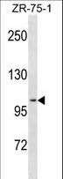 PR / Progesterone Receptor Antibody - PGR Antibody western blot of ZR-75-1 cell line lysates (35 ug/lane). The PGR antibody detected the PGR protein (arrow).