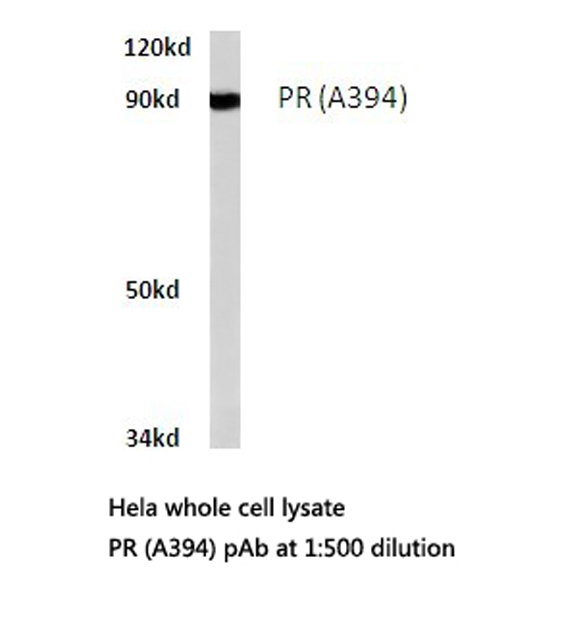 PR / Progesterone Receptor Antibody - Western blot of PR (A394) pAb in extracts from HeLa cells.