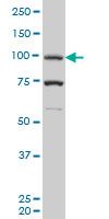 PR / Progesterone Receptor Antibody - PGR monoclonal antibody (M05), clone 1B11 Western blot of PGR expression in K-562.